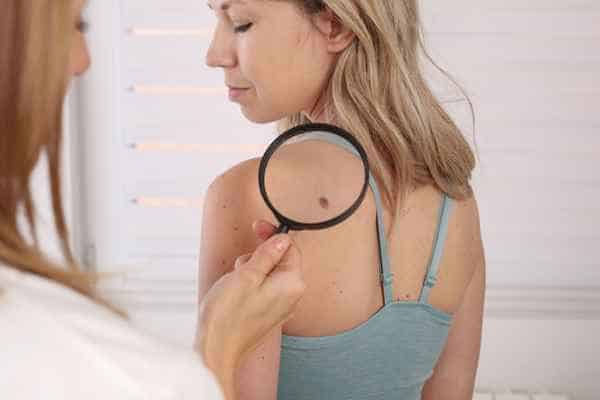What Are Traditional Skin Lesion Removal Methods Market Harborough?