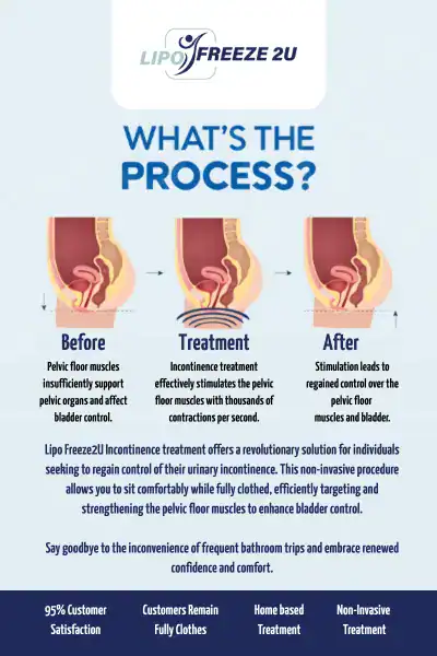 Diagram of how incontinence treatment Market Harborough works.