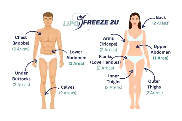 Areas you can have fat freezing treatment Market Harborough