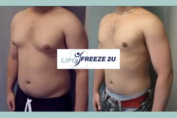 How Long Does It Take to See Results Market Harborough?