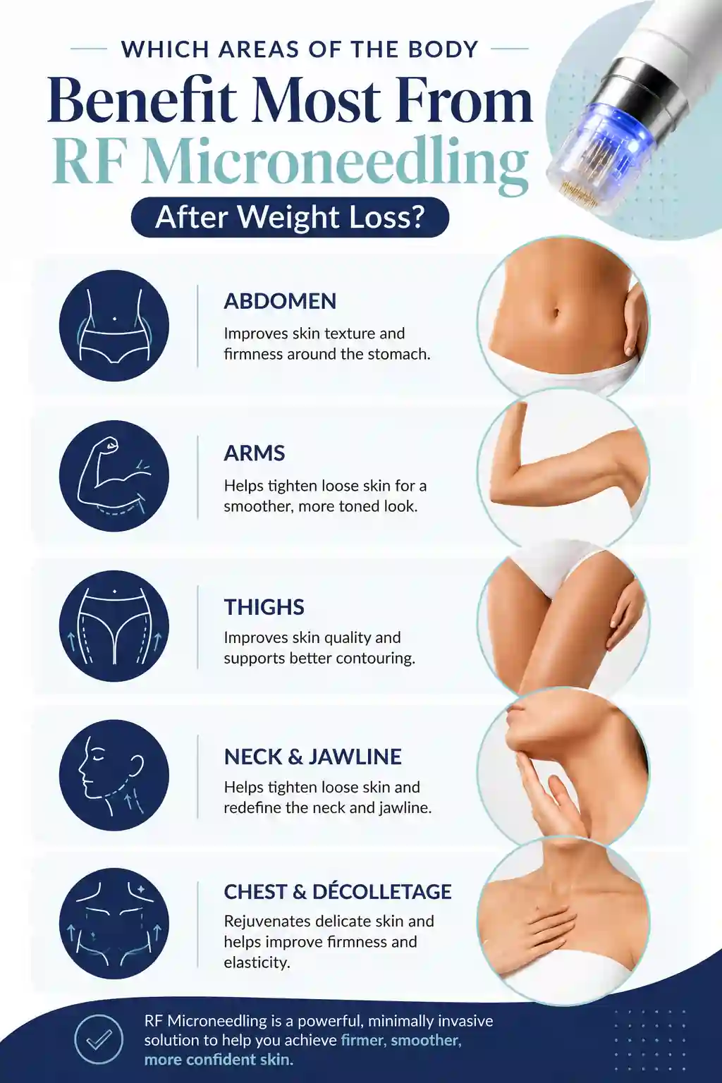Which Areas of the Body Benefit Most From RF Microneedling After Weight Loss Market Harborough